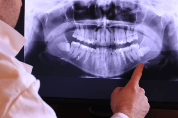 Best Emergency Cosmetic Dentistry in Waxhaw, NC